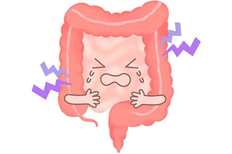 虚血性腸炎とはイメージ画像